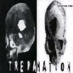 Trepanation